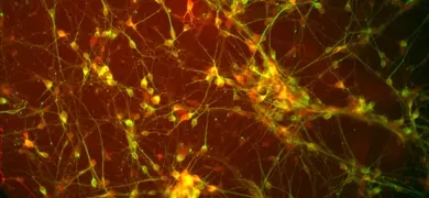Green and red dopaminergic Diff Tuj1 DAPI cells.