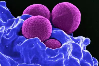 Purple spheres and blue blobs of Methicillin-resistant staphylococcus aureus.