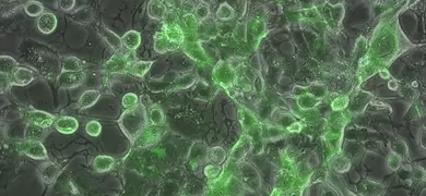 Microscopic image showing small, round, fluorescent green and gray herpes simplex cells.