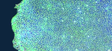 Spherical cluster of tiny, fluorescent blue and green, induced pluripotent stem cells.