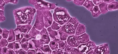  Clusters of dark pink and white choroma cells