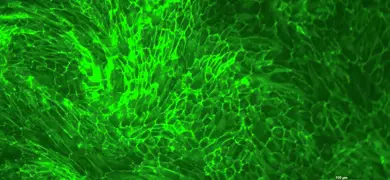 Green hTERT renal proximal tubular epithelial cells
