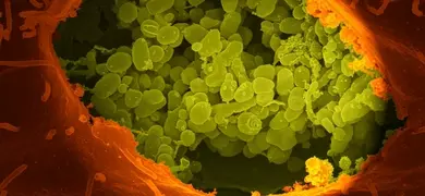 Green and red vero cell.