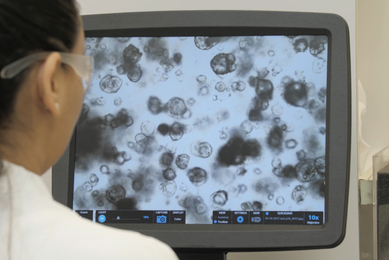A person is looking at a computer screen displaying a microscopic image of cells in black and white, with some cells appearing darker than others.