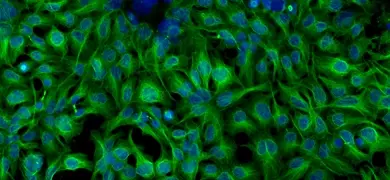 Green and blue beta tubulin cells.