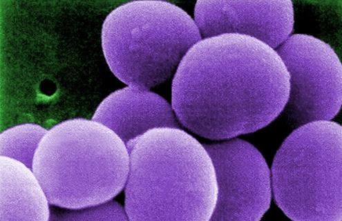 Digitally-colorized scanning electron microscopic (SEM) image shows a strain of Staphylococcus aureus bacteria taken from a vancomycin intermediate resistant culture (VISA).