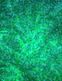 hTERT renal proximal tubular epithelial cells merged