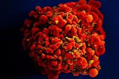 18143_lores_H9-T cell infected by HIV particles_NIAID.jpg