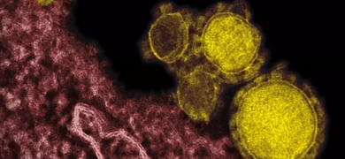 Highly magnified, digitally colorized transmission electron microscopic (TEM) image, reveals ultrastructural details exhibited by five, spherical shaped, Middle East respiratory syndrome coronavirus (MERS-CoV) virions, which were colorized yellow.