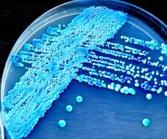 yeast in petri dish iStock-471120110.jpg