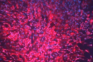 Blue and pink hTERT renal proximal tubular epithelial cells.