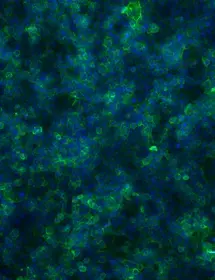 Fluorescent blue and green colon cells.