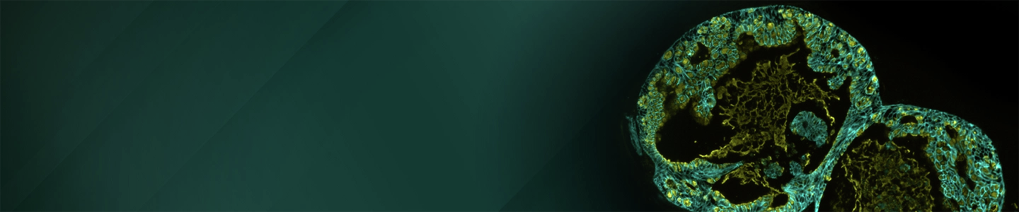 A banner image shows two large circular organoid structures with layered cellular organization, featuring blue‑green cell boundaries and dense golden internal networks, set against a dark teal gradient background on the left.