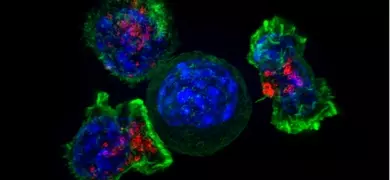 Killer T cells surround a cancer cell Credit Alex Ritter, Jennifer Lippincott Schwartz and Gillian Griffiths, National Institutes of Health.png