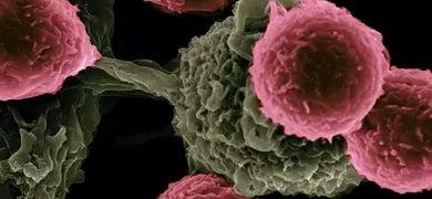Scanning electron microscope image showing a cluster of dendritic T-cells with textured gray-green surfaces and rounded pink tops against a black background.