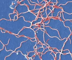 Pale red, tangled strings of the Lyme Disease borrelia burgdorferi bacteria.