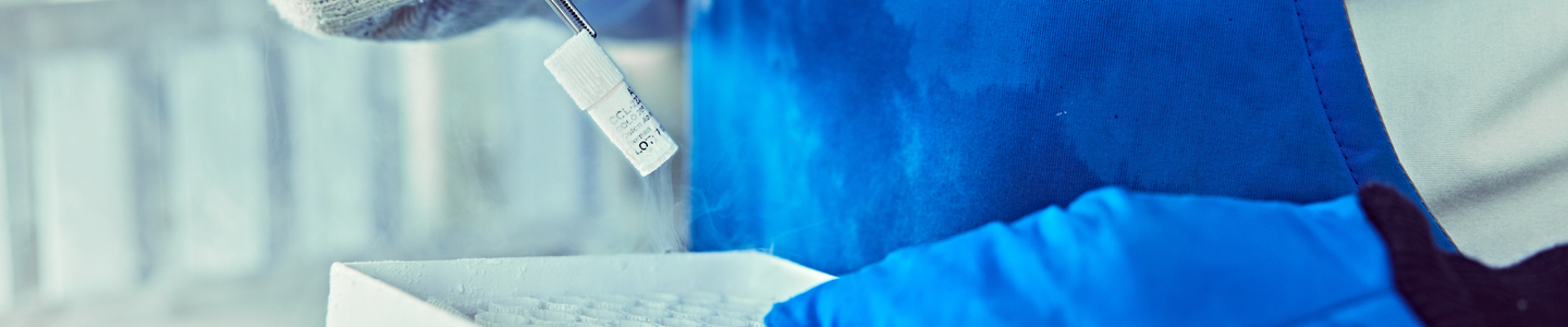A high-resolution, technical photograph of a laboratory technician’s torso and hands while performing cryogenic sample management. The technician is wearing a protective blue cryogenic apron over a white lab coat and is equipped with thick, white cryogenic gloves. They are holding a stainless steel storage rack that contains several white cryoboxes, with a dense cloud of white liquid nitrogen vapor pouring from the rack and the workstation.