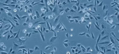Hamster ovary epithelial cells.