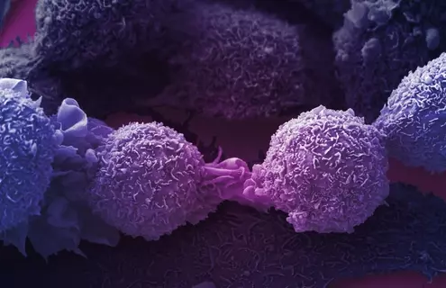 Round, textured, purple lung cancer cells on a dark background.