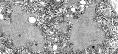 Transmission electron microscopic (TEM) image reveals some of the ultrastructural features exhibited by numerous bullet-shaped, rabies virus particles, as well as cellular inclusions known as Negri bodies.