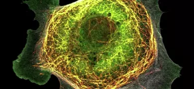 Green and yellow CCL-34 MDCK cells.