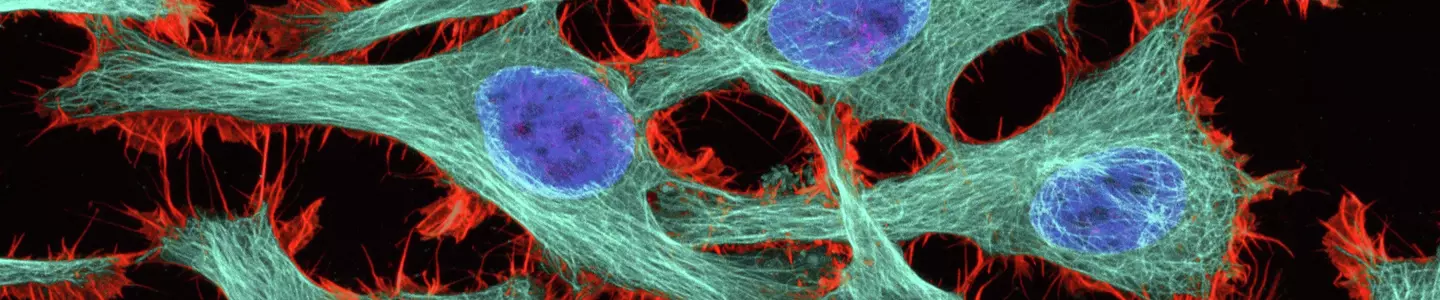 HeLa+cells-III+TJD.jpg