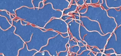 Pale red, tangled strings of the Lyme Disease borrelia burgdorferi bacteria.