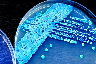 yeast in petri dish iStock-471120110.jpg