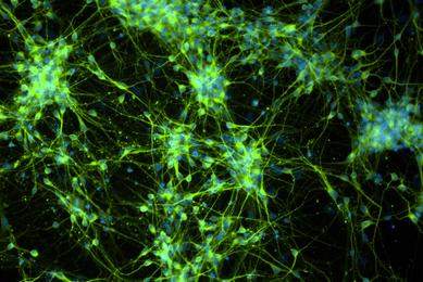 ACS-5003 Dopaminergic Diff MAP2 DAPI