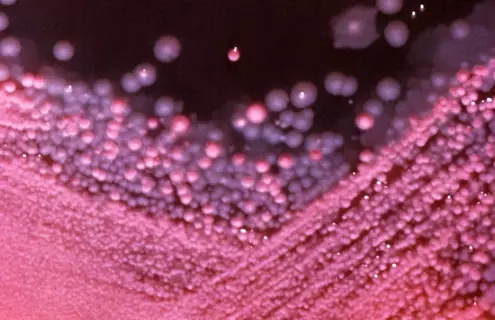 Tiny beads of pink and purple bacteria in MacConkey growth medium.