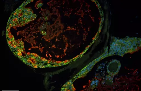 Green, red, and blue organoid cells.