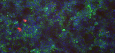 Fluorescent blue and green colon cells.