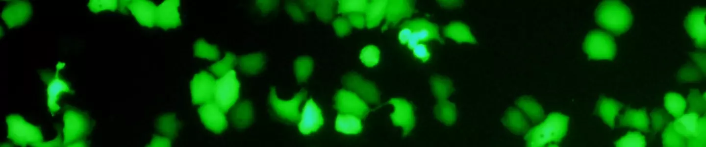 hutu_gfp_2_.jpg