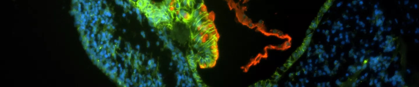 Green, blue and red organoid cells.