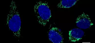 Fluorescent microscopy image showing A375MA-cells with green and blue mitochondrial protein ATPB. The cells have prominent blue nuclei surrounded by green-stained mitochondria. Scale bar indicates 10 µm.