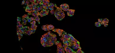 Skov3 ovarian cancer cell line.