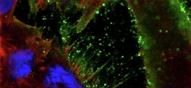 Fluourescent blue, red, and green respiratory synctial virus.