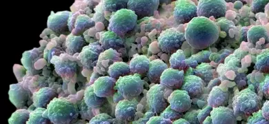 Green prostate cancer cells.