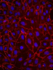 Purple, red and black human umbilical vein endothelial cells.