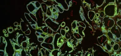 Green and red organoid cells.