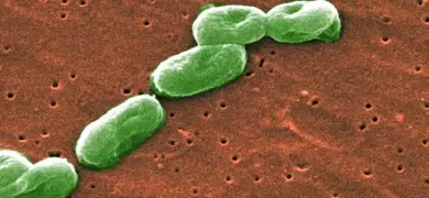 Burkholderia cepacia 10608_lores CDC_Janice Haney Carr.jpg