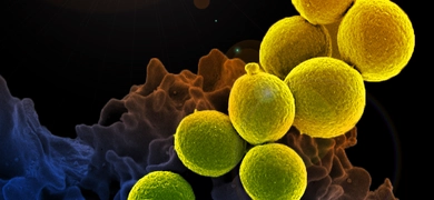 Digitally colorized scanning electron microscope image showing a chain of yellow, spherical methicillin-resistant Staphylococcus aureus (MRSA) bacteria being engulfed by a blue-colored neutrophil.