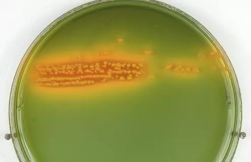 Petri dish culture of E coli bacteria