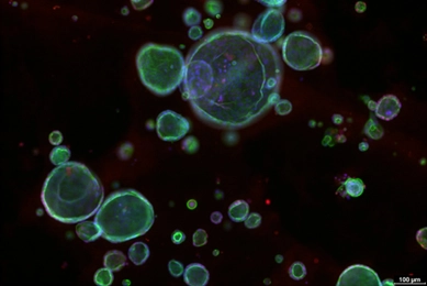Fluorescence microscopy image of organoids stained with DAPI and phalloidin. Blue nuclei and green actin filaments highlight spherical organoids of varying sizes, with a large central organoid surrounded by smaller structures. Scale bar = 100 µm.