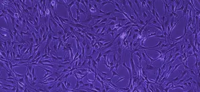 Connecting, long, thin, fluorescent purple, umbilical cord mesenchymal stem cells.