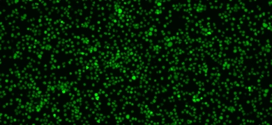 CRL-3580-GFP-Luc2_highdensity_GFP.jpg