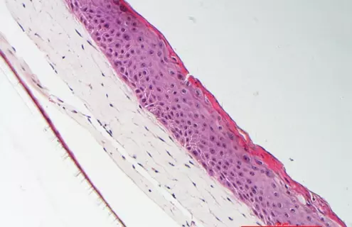 Pink foreskin keratinocyte cells.