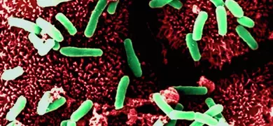 Microscopic image of green rod-shaped Clostridium difficile dispersed across a red and black textured background.