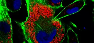 Fluorescent microscopy image showing MDCK cells stained with IFITM3 in red, Phalloidin in green, and DAPI in blue. The cells exhibit distinct red puncta indicating the presence of IFITM3, green filamentous structures representing actin filaments stained by Phalloidin, and blue nuclei stained by DAPI. This image was submitted to ATCC photo contest by Christopher Chin.