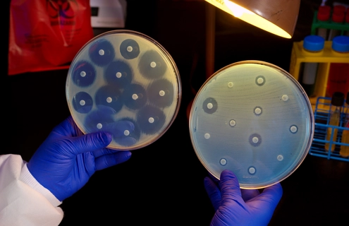 Blue-gloved hands, each holding a petri dish containing white carbapenem resistant, Enterobacteriaceae under an overhead lamp